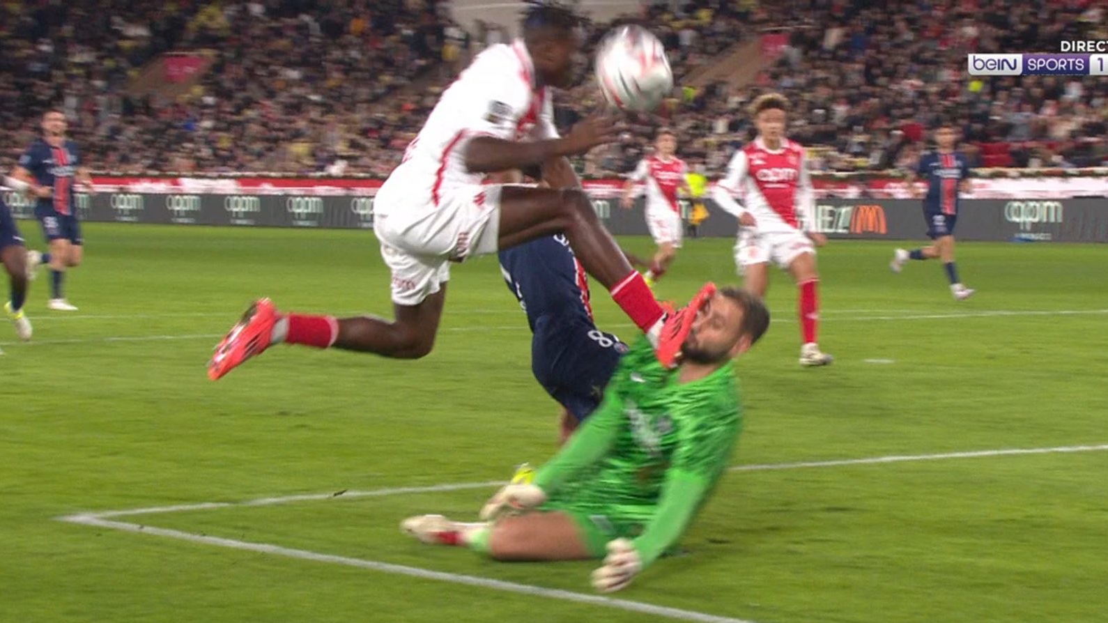 Donnarumma üzündən dəhşətli zədə aldı - VİDEO