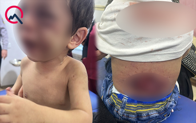 Narkotik basqınına gedən polislər dəhşət yaşadılar - Azərbaycanda ŞOK - FOTO