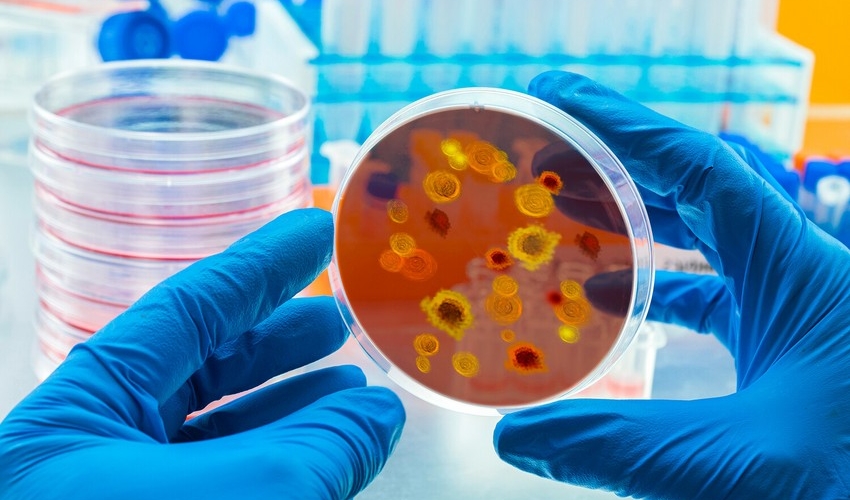 ÜST-dən yeni SOS - Yeni epidemiya GƏLİR