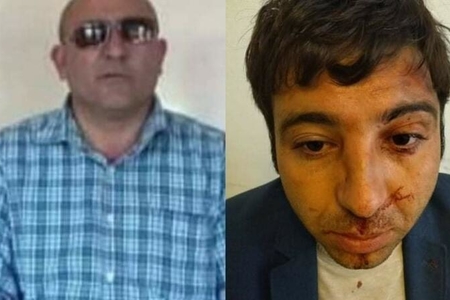Baş redaktora HÜCUM: O, xəstəxanaya yerləşdirildi