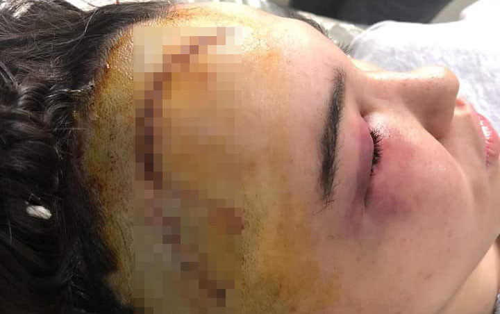 Küləkli havada “Tarqovı”da başına daş düşdü, müalicəsini edən yoxdur - FOTO