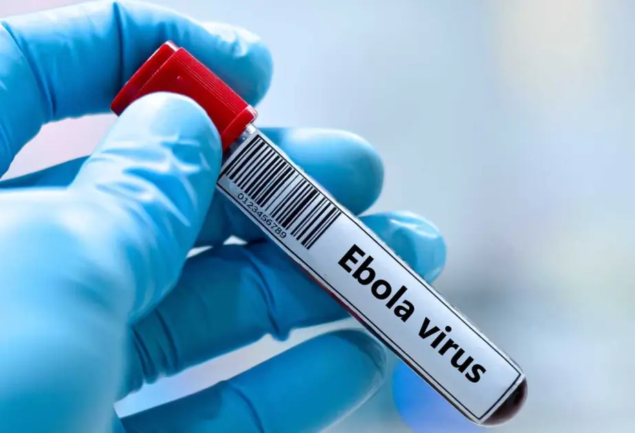 Konqoda Ebola qızdırmasından ölənlərin sayı iki min nəfəri keçib