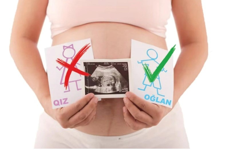 Abortların sayı niyə artır? — "Ər deyir ki, dostlarımın oğlu var, qız istəmirəm" (VİDEO)