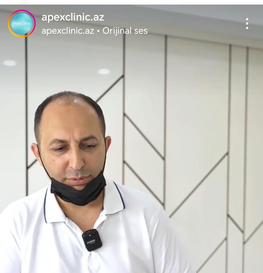 "Apex Clinic"də azyaşlının alveol sümüyü zədələndi - Baş həkim Əli Əliyev 20 min cərimələndi