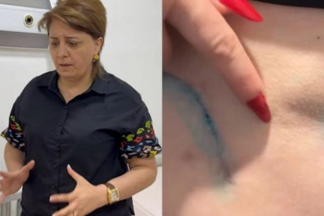 Prokurorluqda pasiyentin ölüm işində adı keçən həkim yenidən cərrahlıq edir? – VİDEO