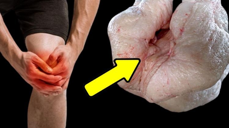 İbn Sinanın diz ağrıları üçün MÖCÜZƏ resepti - QOYUN QUYRUĞU - VİDEO