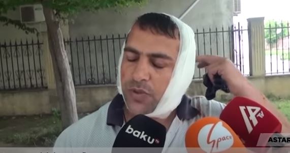 Qulağını eşşək qopardan kişi görün kimdir   —  VİDEO