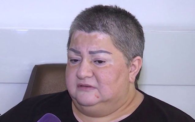 Könül Xasıyevaya xalqa müraciət etdi: "Əməliyyat üçün 254 min lazımdır"