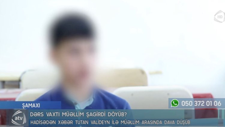 “Başımı lövhəyə, sonra tumbuçkaya vurdu” - Müəllimin döydüyü şagird danışdı - Video