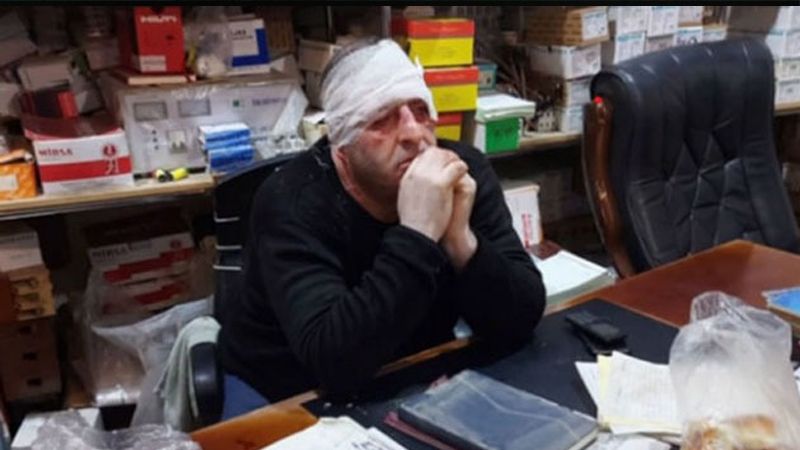 "Sədərək"də Şakir Ağayevin 30 minini oğurlayan şəxs iş adamının qohumu imiş - TƏFƏRRÜAT