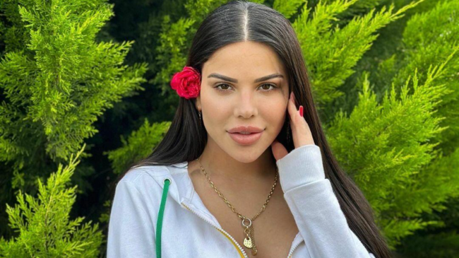 Bədəni çürüyən azərbaycanlı modelin DƏHŞƏTLİ KADRLARI - FOTOLAR 