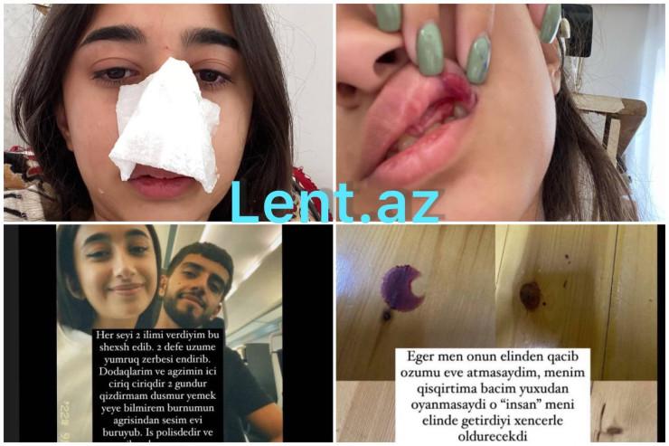 Bakıda sevgilisinin döydüyü qız sosial şəbəkəni AYAĞA QALDIRDI