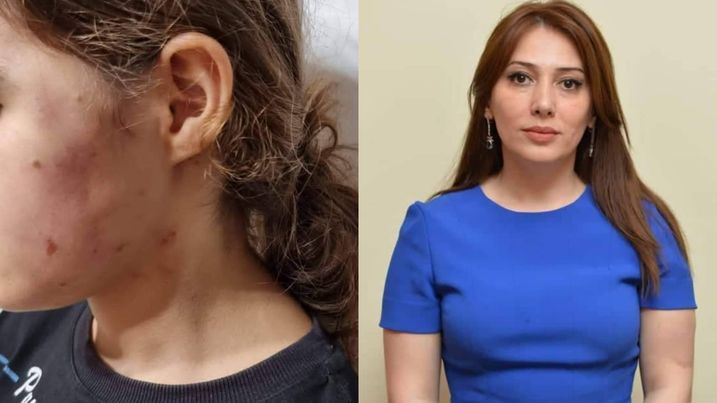 "Bilirsiniz, o, bizə necə qan uddurub?" - Lənkəranda RƏSİLƏ XOFU...
