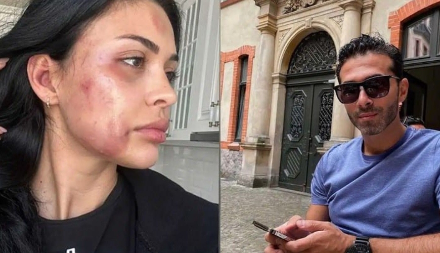 "Sübutlarım var, istintaqa verəcəm" - Razini döydüyü deyilən Ziya DANIŞDI - FOTO