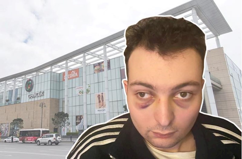 “Gənclik Mall”da autizmli gəncin döyülməsini ört-basdır etməyə çalışıblar? – Fotolar