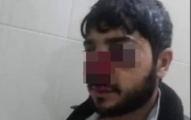 Qubada ağac kəsilməsinə etiraz edən şəxs döyülüb? - Foto